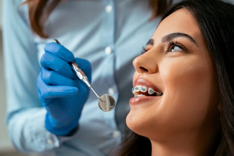 Cum alegi un aparat dentar potrivit problemelor tale? 3 sfaturi utile